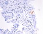 Helicobacter pylori (Catalase) Monoclonal Antibody (HPYL/7170)