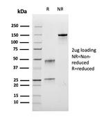 Bromodeoxyuridine (BrdU) Antibody in SDS-PAGE (SDS-PAGE)