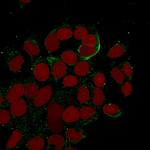 Cytokeratin 10/13 Monoclonal Antibody (DE-K13)