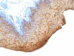 Cytokeratin 10/13 Antibody in Immunohistochemistry (Paraffin) (IHC (P))