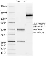 Cytokeratin 10/13 Antibody in SDS-PAGE (SDS-PAGE)