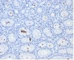 Helicobacter pylori (Catalase) Monoclonal Antibody (HPYL/7171)