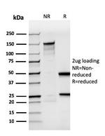 Bromodeoxyuridine (BrdU) Antibody in SDS-PAGE (SDS-PAGE)