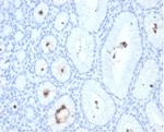 Helicobacter pylori (Catalase) Monoclonal Antibody (HPYL/7172)