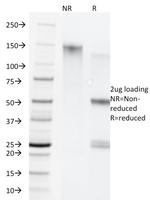 Cytokeratin 5/8 Antibody in SDS-PAGE (SDS-PAGE)
