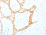 Cytokeratin 5/8 Monoclonal Antibody (C-50)