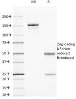 Cytokeratin 7/17 Antibody in SDS-PAGE (SDS-PAGE)