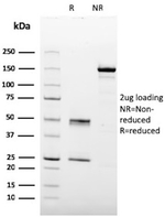 HPV-16 (Human Papilloma Virus 16) Antibody in SDS-PAGE (SDS-PAGE)