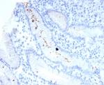 Helicobacter pylori (Catalase) Monoclonal Antibody (HPYL/7225)