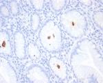 Helicobacter pylori (Catalase) Monoclonal Antibody (HPYL/7227)
