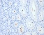 Helicobacter pylori (Catalase) Monoclonal Antibody (HPYL/7228)