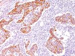 Phosphotyrosine (P-Tyr) Antibody in Immunohistochemistry (Paraffin) (IHC (P))