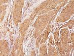 Actin, Muscle Specific (Muscle Cell Marker) Monoclonal Antibody (SPM160)
