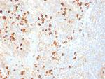 Plasma Cell Marker Monoclonal Antibody (SPM310)