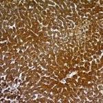 Hepatocyte Specific Antigen (Hepatocellular Marker) Antibody in Immunohistochemistry (Paraffin) (IHC (P))