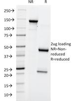 Lewis Y (Tumor Marker) Antibody in SDS-PAGE (SDS-PAGE)