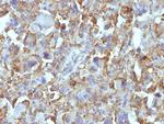 Macrophage and Histiocytoma Marker Monoclonal Antibody (D11)