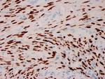 Human Herpes Virus 8 (HHV8) Recombinant Mouse Monoclonal Antibody (HHV8, 3606)