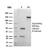 Biotin (Vitamin B7 or Vitamin H) Antibody in SDS-PAGE (SDS-PAGE)