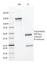 Bromodeoxyuridine (BrdU) (Proliferation Marker) Antibody in SDS-PAGE (SDS-PAGE)