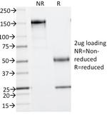 Phosphotyrosine (P-Tyr) Antibody in SDS-PAGE (SDS-PAGE)
