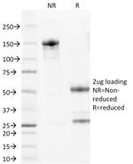 Double Stranded DNA (dsDNA) (Nuclear Marker) Antibody in SDS-PAGE (SDS-PAGE)