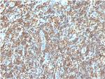 Double Stranded DNA (dsDNA) (Nuclear Marker) Antibody in Immunohistochemistry (Paraffin) (IHC (P))