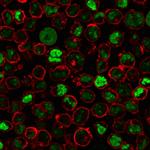 Human Nucleolar Antigen Monoclonal Antibody (NM95)