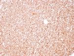 Human Nucleolar Antigen Antibody in Immunohistochemistry (Paraffin) (IHC (P))