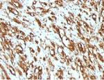 Actin, Muscle Specific (Muscle Cell Marker) Monoclonal Antibody (MSA/953)