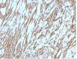 Actin, Muscle Specific (Muscle Cell Marker) Antibody in Immunohistochemistry (Paraffin) (IHC (P))