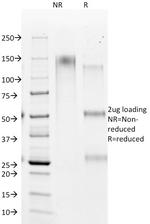 Hepatocyte Specific Antigen (Hepatocellular Marker) Monoclonal Antibody (HSA98)