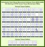 Helicobacter pylori (Catalase) Antibody in Immunohistochemistry (Paraffin) (IHC (P))