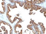 Cytokeratin 8/18 Monoclonal Antibody (5D3)