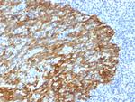 Cytokeratin, Basic (Type II or HMW) Monoclonal Antibody (DE-SQ)