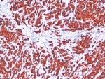 Cytokeratin, pan (Epithelial Marker) Monoclonal Antibody (SPM115, SPM116)