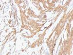 Actin, Muscle Specific (Muscle Cell Marker) Monoclonal Antibody (HHF35, MSA/953)