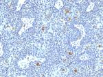 HPV-16 (Human Papilloma Virus 16) Monoclonal Antibody (HPV16/1295)