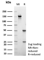 Hepatitis C virus NS3 (Nonstructural protein 3) Antibody in SDS-PAGE (SDS-PAGE)