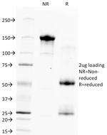 Hepatocyte Specific Antigen (Hepatocellular Marker) Monoclonal Antibody (HSA133)