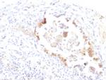 Lewis Y Monoclonal Antibody (LWY, 1463)