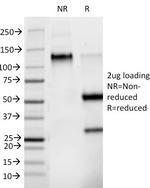 Phosphotyrosine (P-Tyr) Antibody in SDS-PAGE (SDS-PAGE)