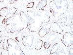 Cytokeratin, Basic (Type II or HMW) Antibody in Immunohistochemistry (Paraffin) (IHC (P))