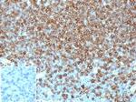 Pan-HLA-II (DP, DQ, DR) Monoclonal Antibody (HLA-Pan/6663)