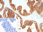 Cytokeratin 5/6 (Basal, Myoepithelial and Mesothelial Cell Marker) Monoclonal Antibody (KRT5.6/9104)