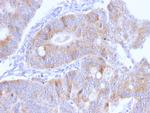Thomsen-Friedenreich Antigen/CD176 (Pan Carcinoma Marker) Antibody in Immunohistochemistry (Paraffin) (IHC (P))