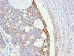 Thomsen-Friedenreich Antigen/CD176 (Pan Carcinoma Marker) Monoclonal Antibody (A63-C/A9)