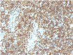 Double Stranded DNA (dsDNA) Antibody in Immunohistochemistry (Paraffin) (IHC (P))