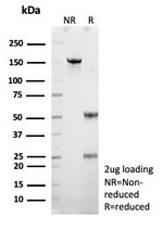 Human Nuclear Antigen (HNA) (Human Cell Marker) Antibody in SDS-PAGE (SDS-PAGE)