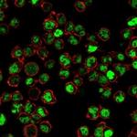Human Nuclear Antigen (HNA) (Human Cell Marker) Antibody in Immunocytochemistry (ICC/IF)